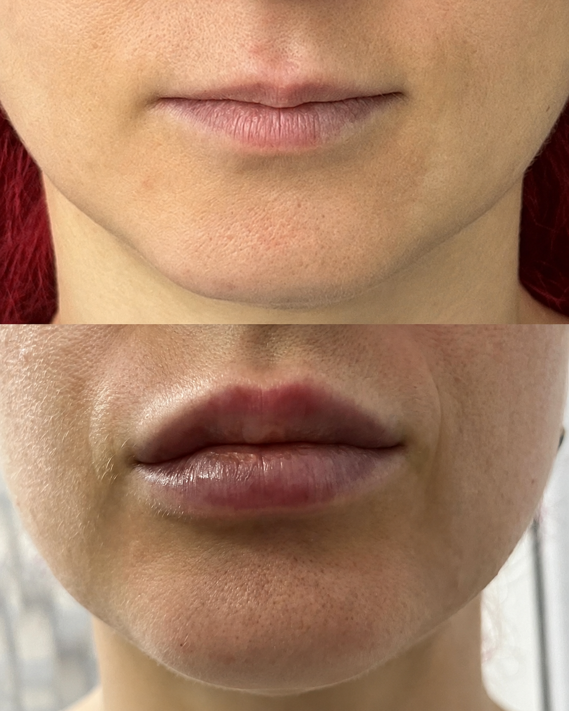 Tratamente dermatologice